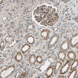 Ephrin-B2 Antibody, Novus Biologicals:Antibodies:Primary Antibodies
