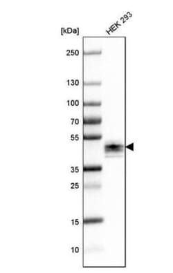 Ephrin-B2 Antibody, Novus Biologicals:Antibodies:Primary Antibodies