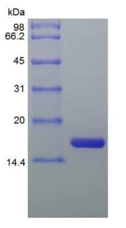 Novus Biologicals Recombinant Equine IL-1ra/IL-1F3/IL1RN Protein 100 &mu;g | Buy Online | Novus Biologicals&trade; | Fisher Scientific