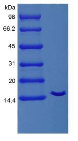 Novus Biologicals Recombinant Equine IL-2 Protein 10 &mu;g | Buy Online | Novus Biologicals&trade; | Fisher Scientific