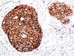 ErbB2/Her2 Antibody (ERB2/776), Novus Biologicals 0.2mg; Unlabeled:Antibodies,