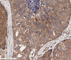 ErbB2/Her2 Antibody - BSA Free, Novus Biologicals 0.025 mg | Buy Online | Novus Biologicals | Fisher Scientific