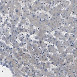 ErbB4/Her4 Antibody, Novus Biologicals 0.1mL; Unlabeled:Antibodies, Polyclonal