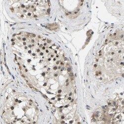 ErbB4/Her4 Antibody, Novus Biologicals 0.1mL; Unlabeled:Antibodies, Polyclonal