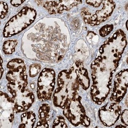 Eukaryotic translation initiation factor 5B Antibody, Novus Biologicals:Antibodies:Primary