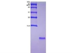 Novus Biologicals Recombinant Exendin-4 Protein 100 &mu;g | Buy Online | Novus Biologicals&trade; | Fisher Scientific