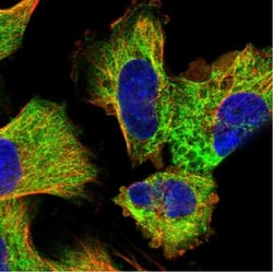 Exosome component 4 Antibody, Novus Biologicals:Antibodies:Primary Antibodies