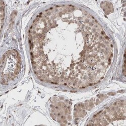 Exosome component 4 Antibody, Novus Biologicals:Antibodies:Primary Antibodies