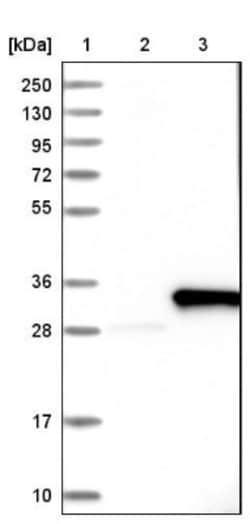 Exosome component 4 Antibody, Novus Biologicals:Antibodies:Primary Antibodies