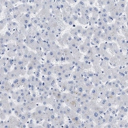 Exportin-5 Antibody, Novus Biologicals:Antibodies:Primary Antibodies