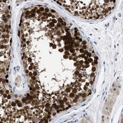 Exportin-5 Antibody, Novus Biologicals:Antibodies:Primary Antibodies