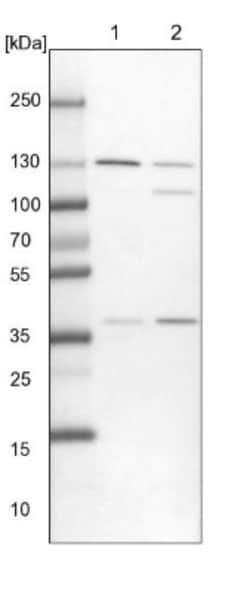Exportin-5 Antibody, Novus Biologicals 0.1mL; Unlabeled:Antibodies, Polyclonal