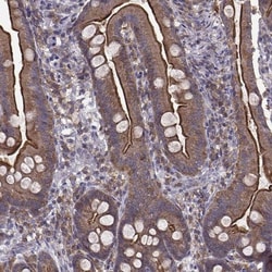 Ezrin Antibody (CL2384), Novus Biologicals:Antibodies:Primary Antibodies