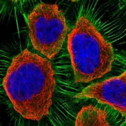 PGM1 Antibody, Novus Biologicals:Antibodies:Primary Antibodies