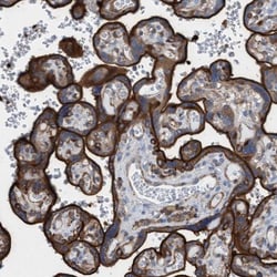 PGM1 Antibody, Novus Biologicals:Antibodies:Primary Antibodies