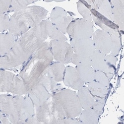 PGM1 Antibody, Novus Biologicals:Antibodies:Primary Antibodies