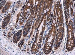 Ezrin Antibody, Novus Biologicals 0.1mL; Unlabeled:Antibodies, Polyclonal