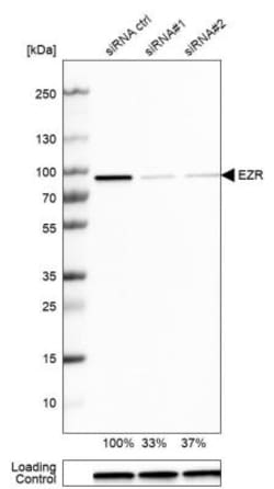 PGM1 Antibody, Novus Biologicals:Antibodies:Primary Antibodies