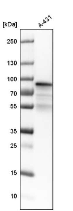 PGM1 Antibody, Novus Biologicals:Antibodies:Primary Antibodies