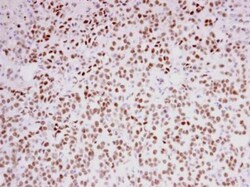 anti-F-box protein 43, Polyclonal, Novus Biologicals 0.1mg; Unlabeled:Antibodies,