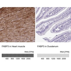 FABP3/H-FABP Antibody, Novus Biologicals:Antibodies:Primary Antibodies