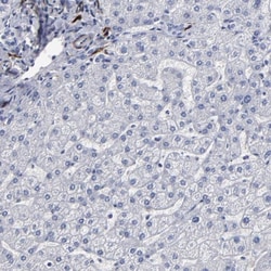FABP4/A-FABP Antibody, Novus Biologicals 0.1mL; Unlabeled:Antibodies, Polyclonal