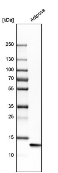 FABP4/A-FABP Antibody, Novus Biologicals 0.1mL; Unlabeled:Antibodies, Polyclonal