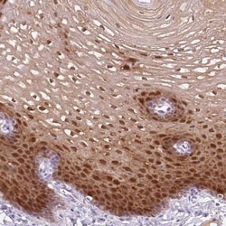 FABP5/E-FABP Antibody, Novus Biologicals 0.1mL; Unlabeled:Antibodies, Polyclonal
