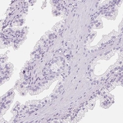 FABP5/E-FABP Antibody, Novus Biologicals 0.1mL; Unlabeled:Antibodies, Polyclonal