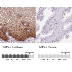 FABP5/E-FABP Antibody, Novus Biologicals 0.1mL; Unlabeled:Antibodies, Polyclonal