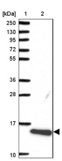 FABP5/E-FABP Antibody, Novus Biologicals 0.1mL; Unlabeled:Antibodies, Polyclonal