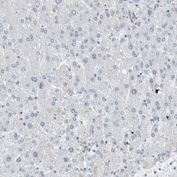 FABP6 Antibody, Novus Biologicals 25 &mu;L | Buy Online | Novus Biologicals | Fisher Scientific