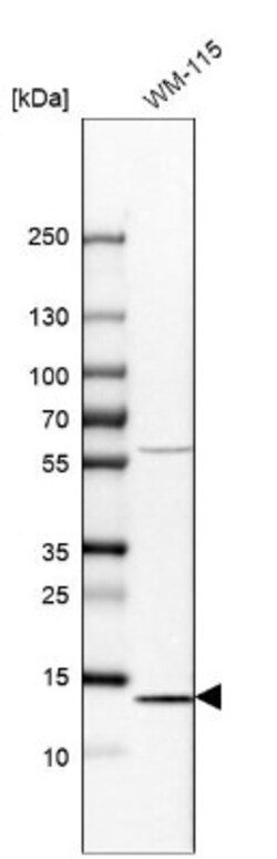 FABP7/B-FABP Antibody, Novus Biologicals 0.1mL; Unlabeled:Antibodies, Polyclonal