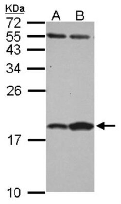 FABP7/B-FABP Antibody, Novus Biologicals 0.1mL; Unlabeled:Antibodies, Polyclonal