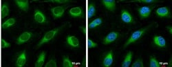 FACL4 Antibody, Novus Biologicals 0.1mL; Unlabeled:Antibodies, Polyclonal