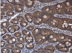 FACL4 Antibody, Novus Biologicals 0.1mL; Unlabeled:Antibodies, Polyclonal