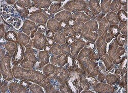FACL4 Antibody, Novus Biologicals 0.1mL; Unlabeled:Antibodies, Polyclonal