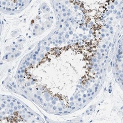 FAIM2 Antibody, Novus Biologicals 25 &mu;L; Unlabeled:Antibodies, Polyclonal