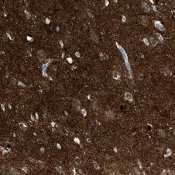 FAIM2 Antibody, Novus Biologicals 25 &mu;L; Unlabeled:Antibodies, Polyclonal