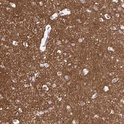 FAIM2 Antibody, Novus Biologicals 0.1mL; Unlabeled:Antibodies, Polyclonal