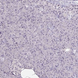 FAIM2 Antibody, Novus Biologicals 0.1mL; Unlabeled:Antibodies, Polyclonal