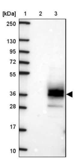 FAIM2 Antibody, Novus Biologicals 0.1mL; Unlabeled:Antibodies, Polyclonal