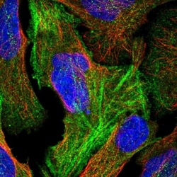 FAM101B Antibody, Novus Biologicals 0.1mL; Unlabeled:Antibodies, Polyclonal