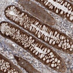 FAM102B Antibody, Novus Biologicals 25 &mu;L; Unlabeled:Antibodies, Polyclonal