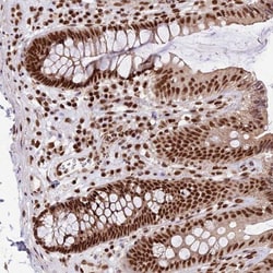 FAM103A1 Antibody, Novus Biologicals:Antibodies:Primary Antibodies