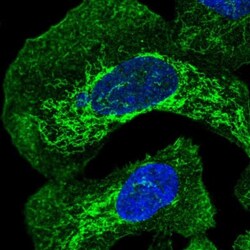 FAM105B/OTULIN Antibody, Novus Biologicals 0.1mL; Unlabeled:Antibodies,