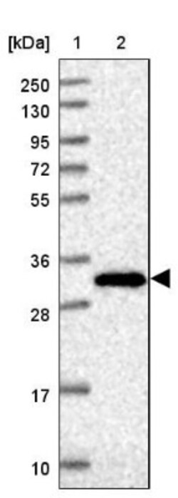 FAM108C1 Antibody, Novus Biologicals 0.1mL; Unlabeled:Antibodies, Polyclonal
