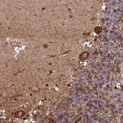 FAM113A Antibody, Novus Biologicals 0.1mL; Unlabeled:Antibodies, Polyclonal