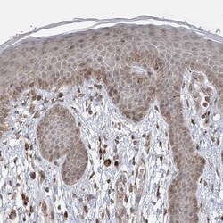 FAM119A Antibody, Novus Biologicals 0.1mL; Unlabeled:Antibodies, Polyclonal