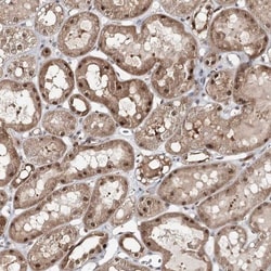 FAM120B Antibody, Novus Biologicals 25 &mu;L; Unlabeled:Antibodies, Polyclonal